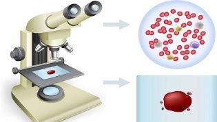 fumar y donar sangre para análisis