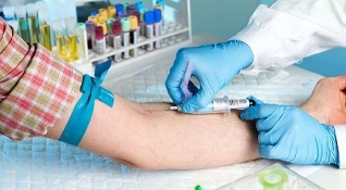 fumar y hacerse un análisis de sangre de una vena